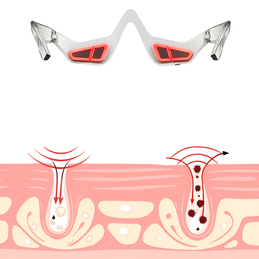 LumiLift – Red Light Eyewear for Under-Eye Rejuvenation